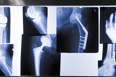 波奇本子：手账新篇章，梦幻波奇绘生活